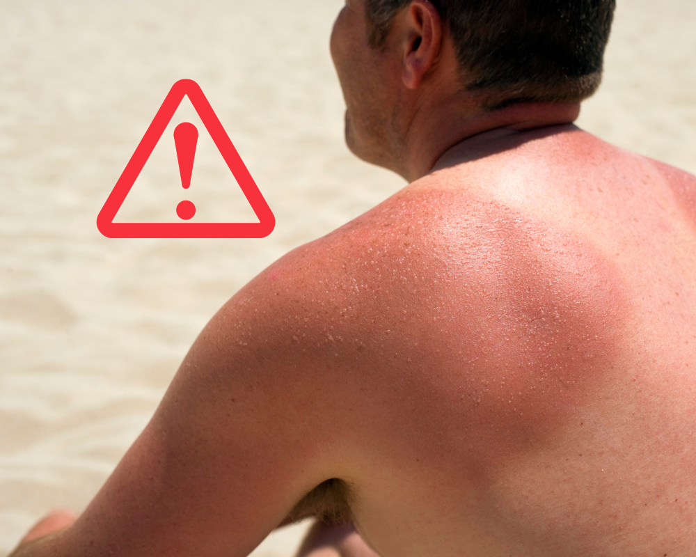 voile dombrage protection coups de soleil